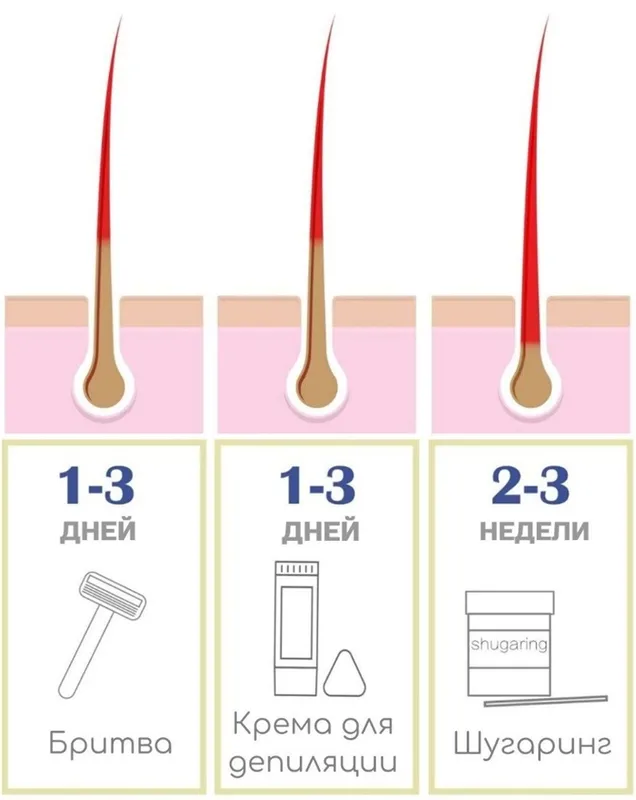 Преимущества шугаринга - волосы не растут 2-3 недели