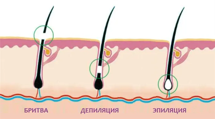 Разница между депиляцией и эпиляцией по глубине воздействия на волос