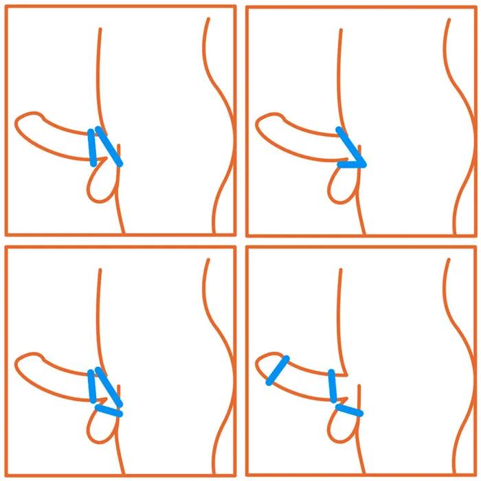 Как надеть 2 эрекционных кольца