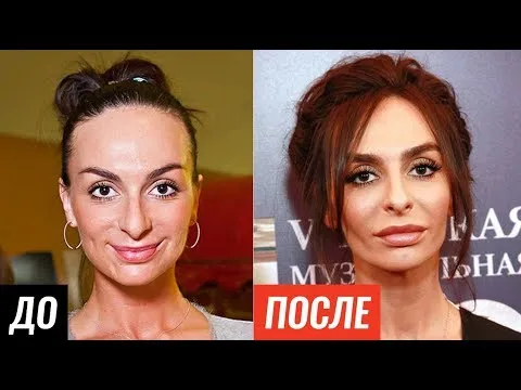 Ксения Стриж после пластики